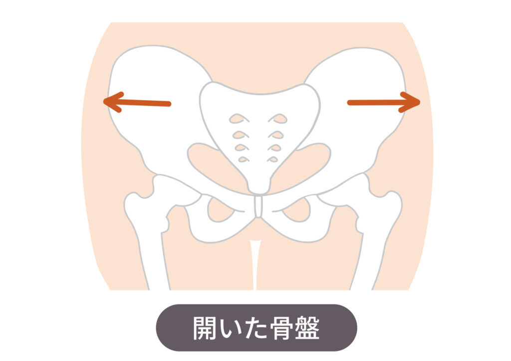 出産直後は骨盤が開いて不安定になっている様子を示す骨盤のイラスト。