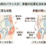 筋肉のバランスが骨盤の位置を決めます