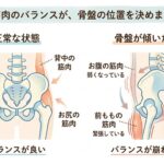 筋肉のバランスが骨盤の位置を決めます